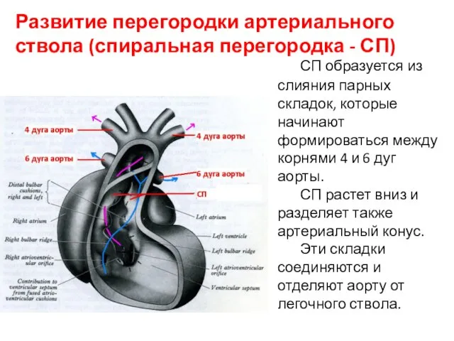 Развитие перегородки артериального ствола (спиральная перегородка - СП) СП образуется из