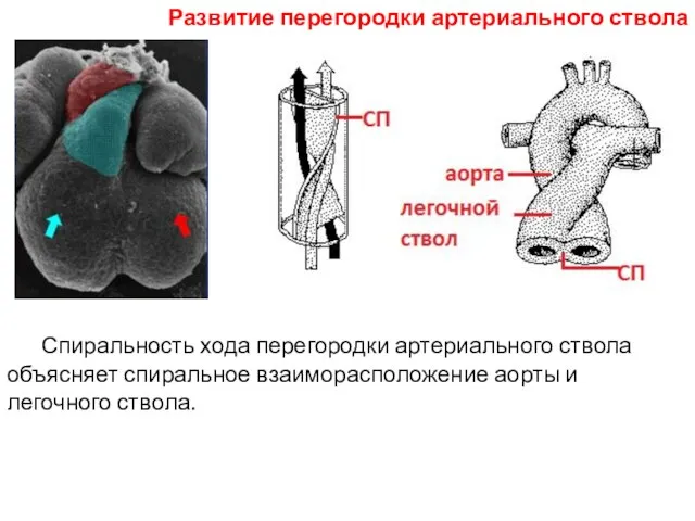 Спиральность хода перегородки артериального ствола объясняет спиральное взаиморасположение аорты и легочного ствола. Развитие перегородки артериального ствола