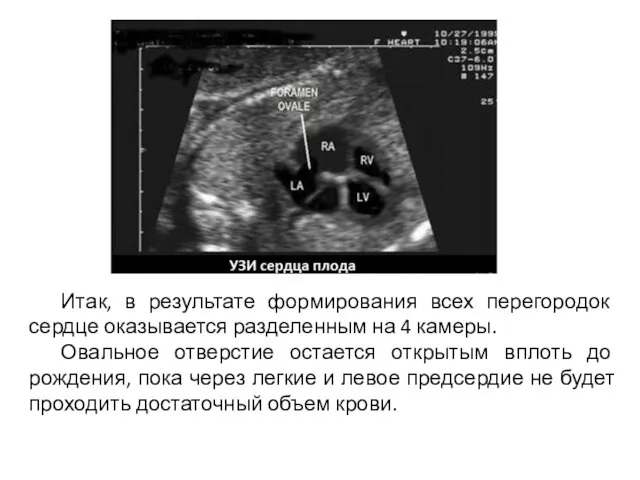 Итак, в результате формирования всех перегородок сердце оказывается разделенным на 4