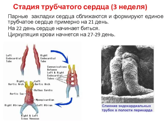 Стадия трубчатого сердца (3 неделя) Парные закладки сердца сближаются и формируют