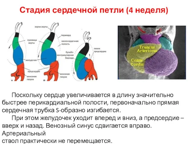 Стадия сердечной петли (4 неделя) Поскольку сердце увеличивается в длину значительно