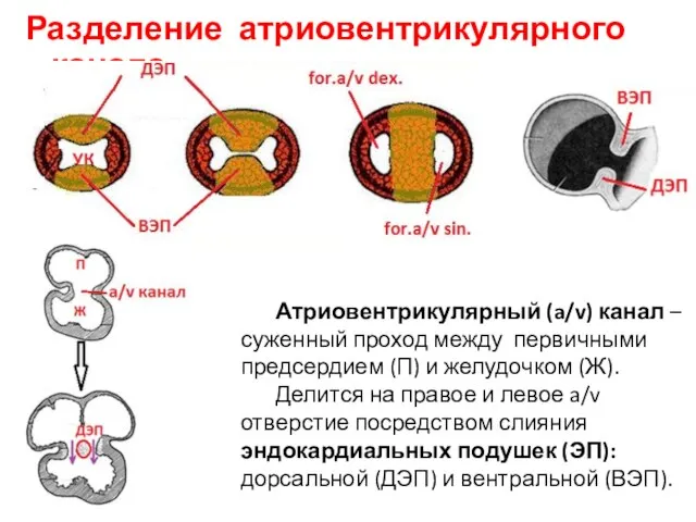 Разделение атриовентрикулярного канала Атриовентрикулярный (a/v) канал – суженный проход между первичными