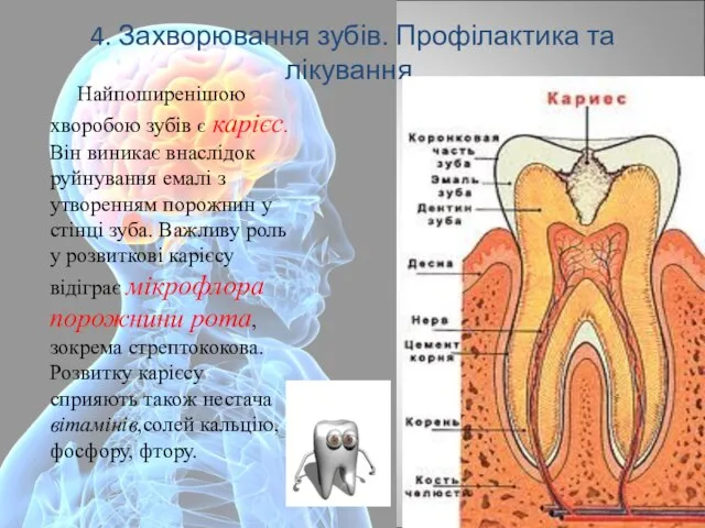4. Захворювання зубів. Профілактика та лікування. Найпоширенішою хворобою зубів є карієс.