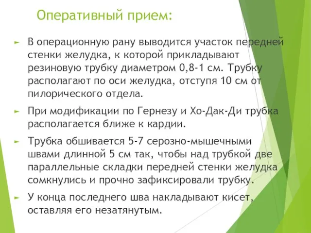 Оперативный прием: В операционную рану выводится участок передней стенки желудка, к