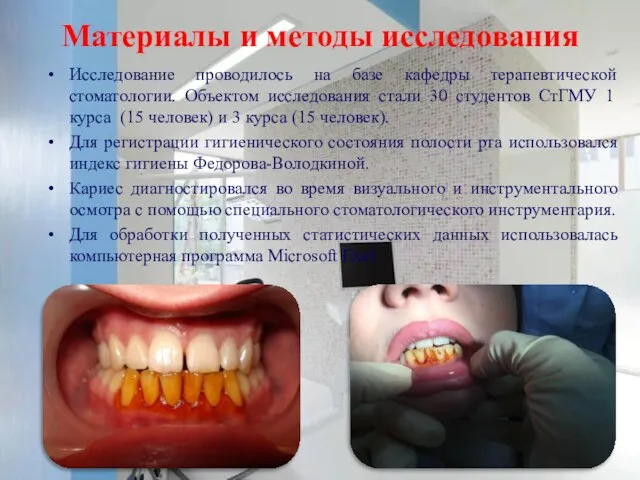 Материалы и методы исследования Исследование проводилось на базе кафедры терапевтической стоматологии.