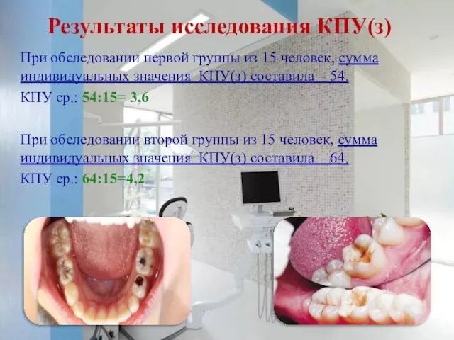 Результаты исследования КПУ(з) При обследовании первой группы из 15 человек, сумма