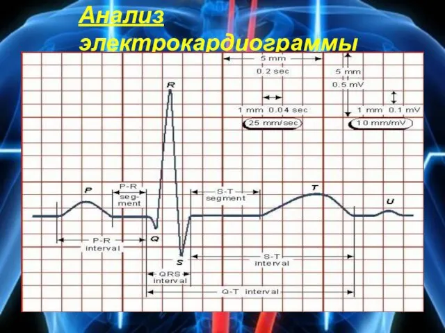 Анализ электрокардиограммы