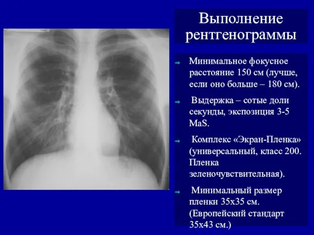 Выполнение рентгенограммы Минимальное фокусное расстояние 150 см (лучше, если оно больше