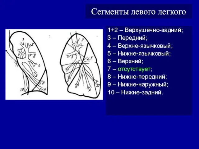 Сегменты левого легкого 1+2 – Верхушечно-задний; 3 – Передний; 4 –