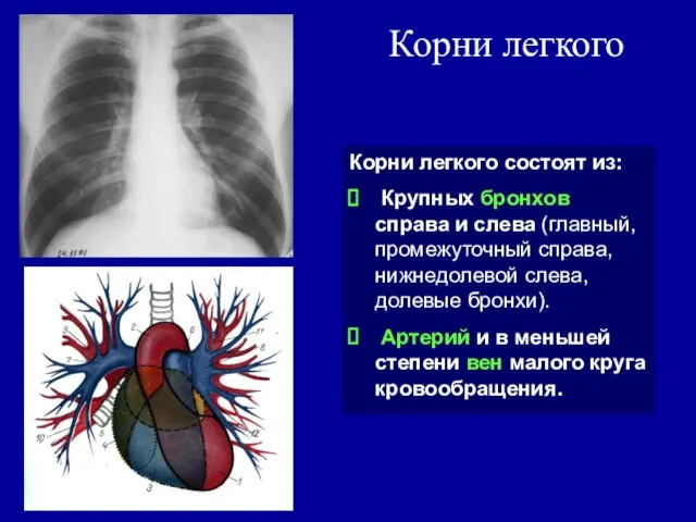 Корни легкого Корни легкого состоят из: Крупных бронхов справа и слева