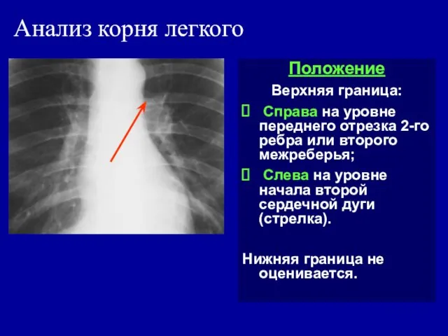 Анализ корня легкого Положение Верхняя граница: Справа на уровне переднего отрезка