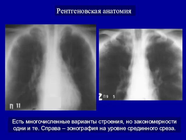 Рентгеновская анатомия Есть многочисленные варианты строения, но закономерности одни и те.