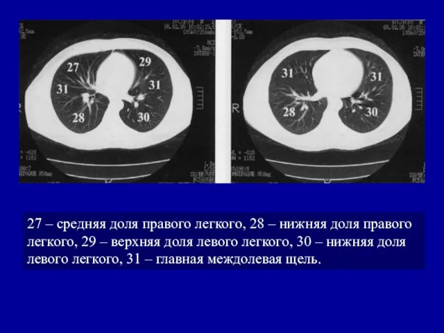 27 – средняя доля правого легкого, 28 – нижняя доля правого