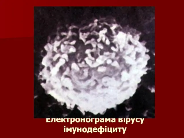 Електронограма вірусу імунодефіциту