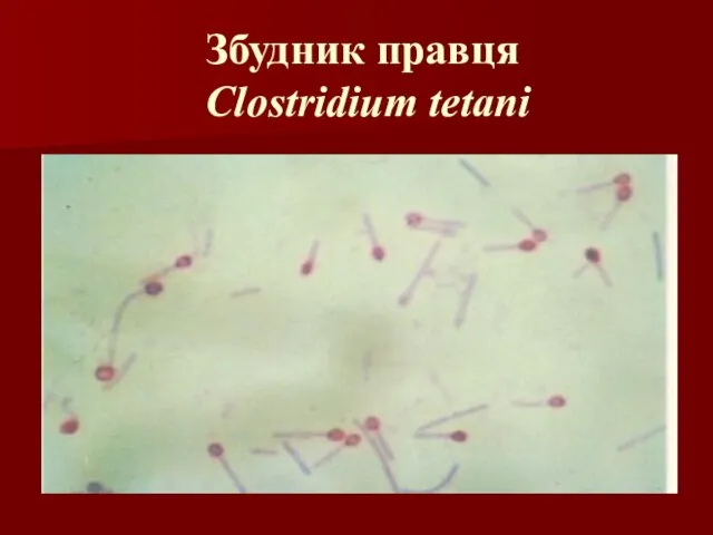 Збудник правця Clostridium tetani