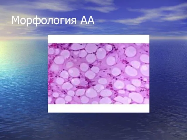 Морфология АА