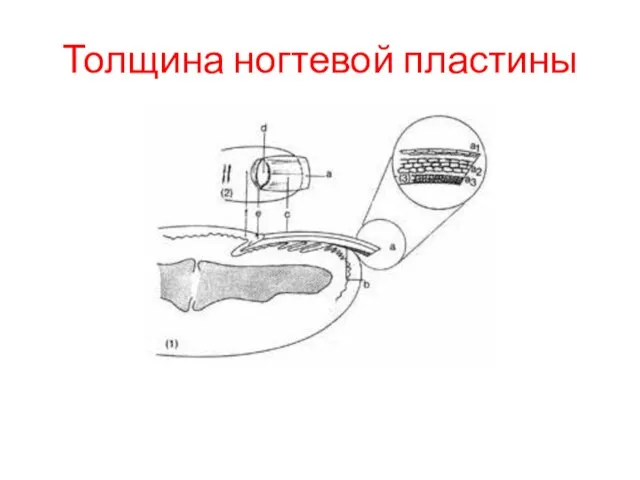 Толщина ногтевой пластины