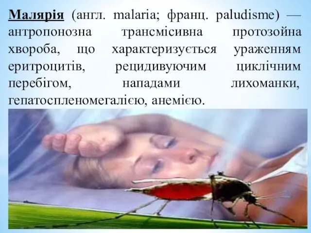 Малярія (англ. malaria; франц. paludisme) — антропонозна трансмісивна протозойна хвороба, що