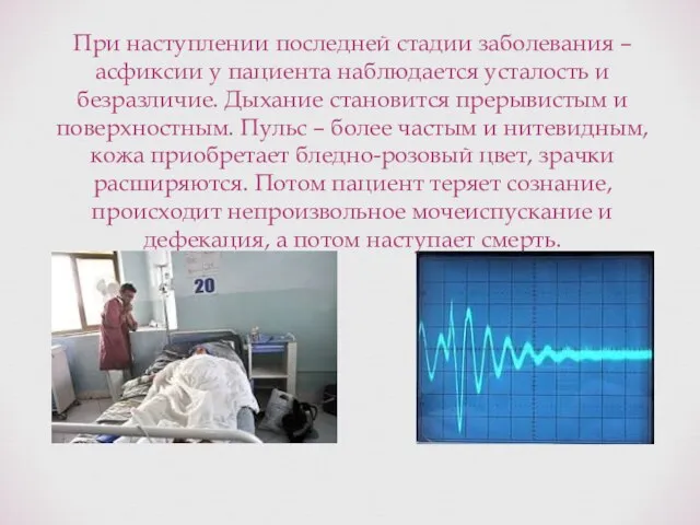 При наступлении последней стадии заболевания – асфиксии у пациента наблюдается усталость