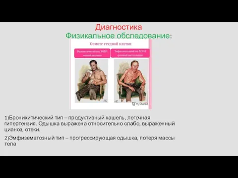 Диагностика Физикальное обследование: 1)Бронихитический тип – продуктивный кашель, легочная гипертензия. Одышка