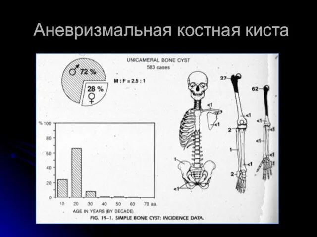 Аневризмальная костная киста