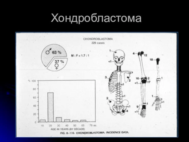 Хондробластома