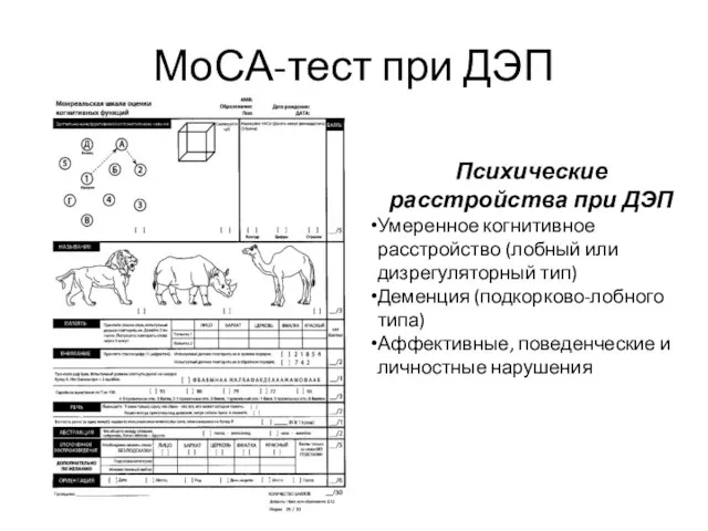 МоСА-тест при ДЭП Психические расстройства при ДЭП Умеренное когнитивное расстройство (лобный