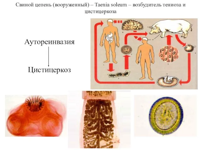 Свиной цепень (вооруженный) – Taenia soleum – возбудитель тениоза и цистицеркоза Аутореинвазия Цистицеркоз