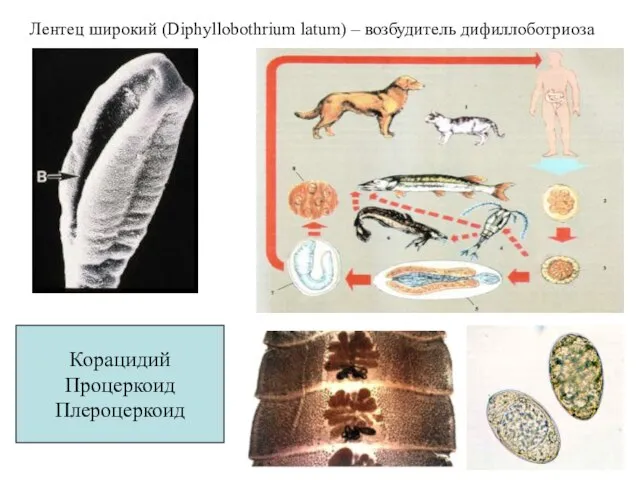 Лентец широкий (Diphyllobothrium latum) – возбудитель дифиллоботриоза Корацидий Процеркоид Плероцеркоид