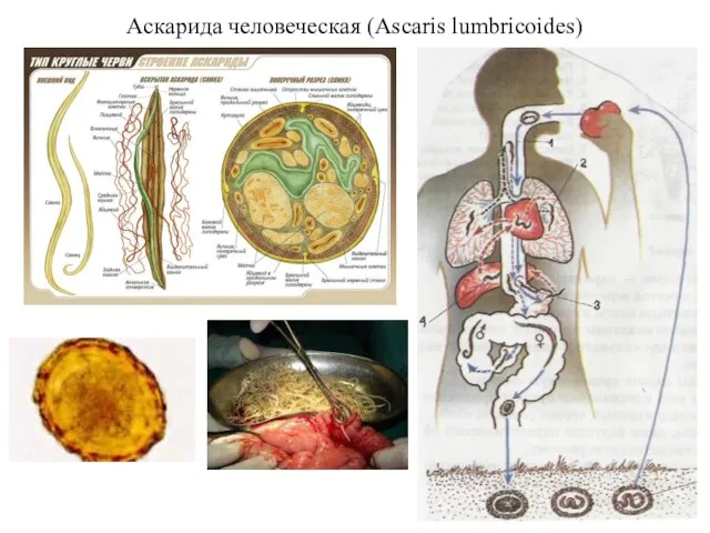 Аскарида человеческая (Ascaris lumbricoides)