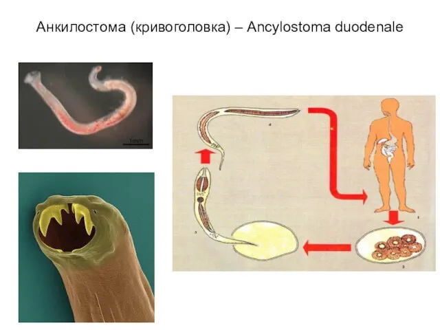 Анкилостома (кривоголовка) – Ancylostoma duodenale