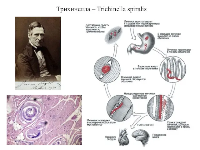 Трихинелла – Trichinella spiralis