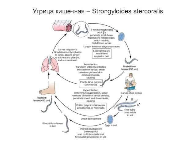 Угрица кишечная – Strongyloides stercoralis