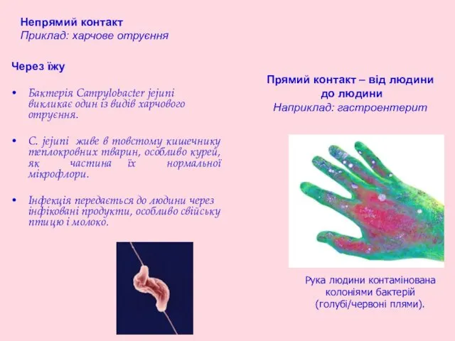 Прямий контакт – від людини до людини Наприклад: гастроентерит Рука людини