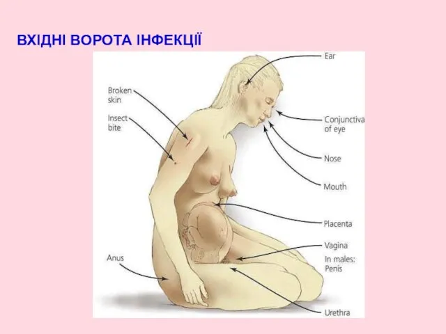 ВХІДНІ ВОРОТА ІНФЕКЦІЇ