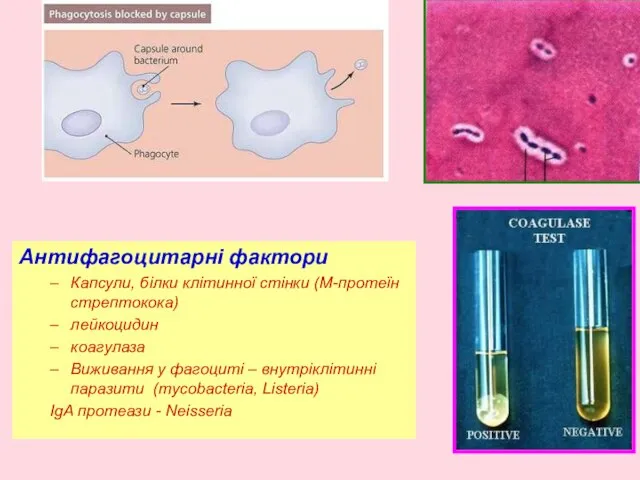 Антифагоцитарні фактори Капсули, білки клітинної стінки (М-протеїн стрептокока) лейкоцидин коагулаза Виживання