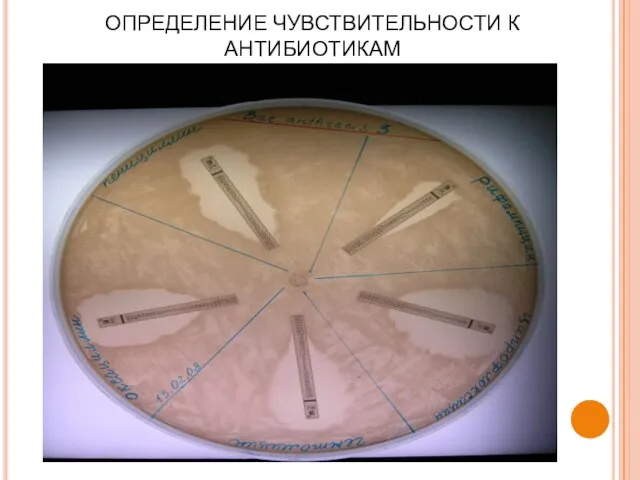 ОПРЕДЕЛЕНИЕ ЧУВСТВИТЕЛЬНОСТИ К АНТИБИОТИКАМ