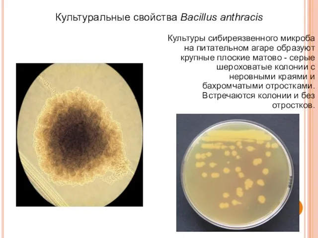 Культуры сибиреязвенного микроба на питательном агаре образуют крупные плоские матово -