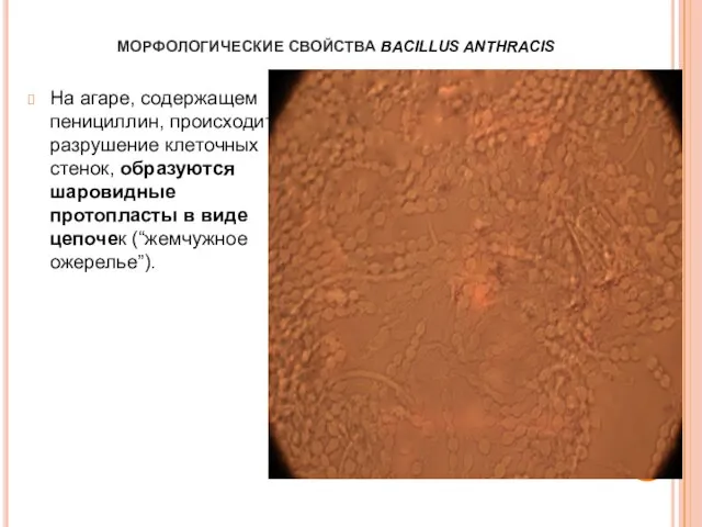 МОРФОЛОГИЧЕСКИЕ СВОЙСТВА BACILLUS ANTHRACIS На агаре, содержащем пенициллин, происходит разрушение клеточных