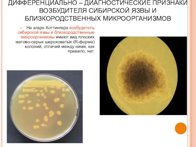 ДИФФЕРЕНЦИАЛЬНО – ДИАГНОСТИЧЕСКИЕ ПРИЗНАКИ ВОЗБУДИТЕЛЯ СИБИРСКОЙ ЯЗВЫ И БЛИЗКОРОДСТВЕННЫХ МИКРООРГАНИЗМОВ На