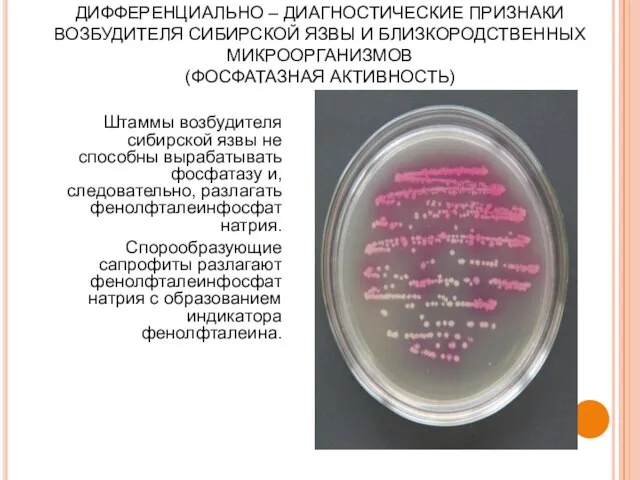 ДИФФЕРЕНЦИАЛЬНО – ДИАГНОСТИЧЕСКИЕ ПРИЗНАКИ ВОЗБУДИТЕЛЯ СИБИРСКОЙ ЯЗВЫ И БЛИЗКОРОДСТВЕННЫХ МИКРООРГАНИЗМОВ (ФОСФАТАЗНАЯ