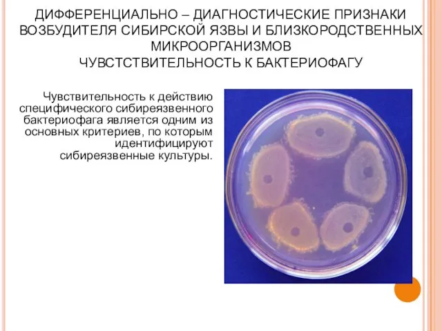 ДИФФЕРЕНЦИАЛЬНО – ДИАГНОСТИЧЕСКИЕ ПРИЗНАКИ ВОЗБУДИТЕЛЯ СИБИРСКОЙ ЯЗВЫ И БЛИЗКОРОДСТВЕННЫХ МИКРООРГАНИЗМОВ ЧУВСТСТВИТЕЛЬНОСТЬ