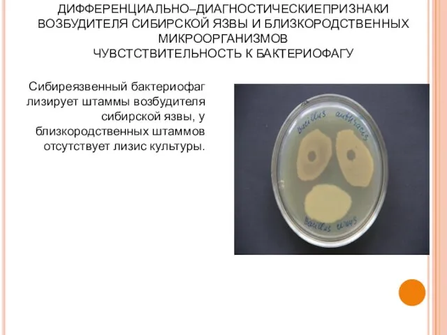 ДИФФЕРЕНЦИАЛЬНО–ДИАГНОСТИЧЕСКИЕПРИЗНАКИ ВОЗБУДИТЕЛЯ СИБИРСКОЙ ЯЗВЫ И БЛИЗКОРОДСТВЕННЫХ МИКРООРГАНИЗМОВ ЧУВСТСТВИТЕЛЬНОСТЬ К БАКТЕРИОФАГУ Сибиреязвенный