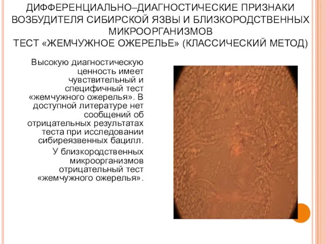 ДИФФЕРЕНЦИАЛЬНО–ДИАГНОСТИЧЕСКИЕ ПРИЗНАКИ ВОЗБУДИТЕЛЯ СИБИРСКОЙ ЯЗВЫ И БЛИЗКОРОДСТВЕННЫХ МИКРООРГАНИЗМОВ ТЕСТ «ЖЕМЧУЖНОЕ ОЖЕРЕЛЬЕ»