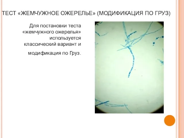 ТЕСТ «ЖЕМЧУЖНОЕ ОЖЕРЕЛЬЕ» (МОДИФИКАЦИЯ ПО ГРУЗ) Для постановки теста «жемчужного ожерелья»