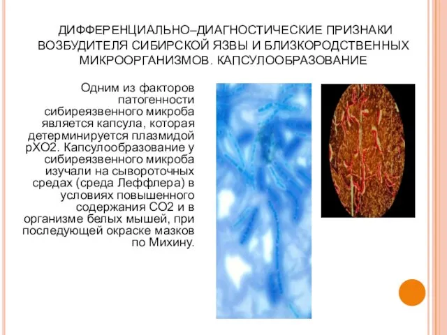 ДИФФЕРЕНЦИАЛЬНО–ДИАГНОСТИЧЕСКИЕ ПРИЗНАКИ ВОЗБУДИТЕЛЯ СИБИРСКОЙ ЯЗВЫ И БЛИЗКОРОДСТВЕННЫХ МИКРООРГАНИЗМОВ. КАПСУЛООБРАЗОВАНИЕ Одним из