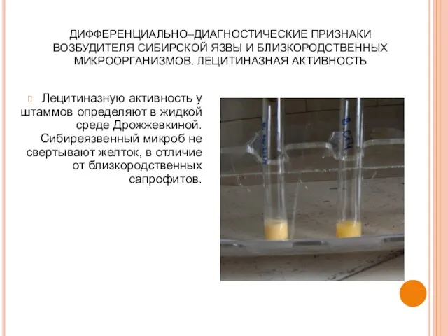 ДИФФЕРЕНЦИАЛЬНО–ДИАГНОСТИЧЕСКИЕ ПРИЗНАКИ ВОЗБУДИТЕЛЯ СИБИРСКОЙ ЯЗВЫ И БЛИЗКОРОДСТВЕННЫХ МИКРООРГАНИЗМОВ. ЛЕЦИТИНАЗНАЯ АКТИВНОСТЬ Лецитиназную