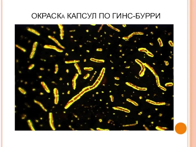 ОКРАСКа КАПСУЛ ПО ГИНС-БУРРИ