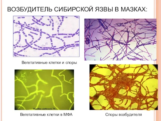 ВОЗБУДИТЕЛЬ СИБИРСКОЙ ЯЗВЫ В МАЗКАХ: Вегетативные клетки и споры Вегетативные клетки в МФА Споры возбудителя