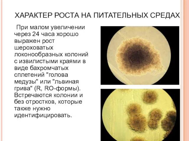 ХАРАКТЕР РОСТА НА ПИТАТЕЛЬНЫХ СРЕДАХ При малом увеличении через 24 часа